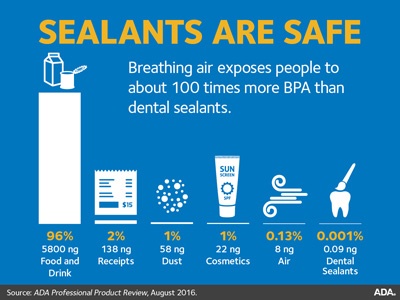 Sealants - Innovate Dental Marketing - Dental Marketing