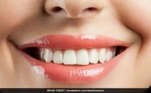 Woman Smiling - Innovate Dental Marketing - Dental Marketing